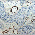 imunohistoquimica